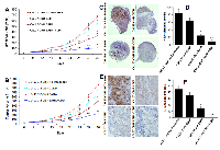 Figure 7:  SAHA and cisplatin treatment significantly decrease tumor growth and tumor metastasis. 