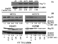 Figure 2:  Hsp70 expression is reduced by triptolide in mesothelioma. 