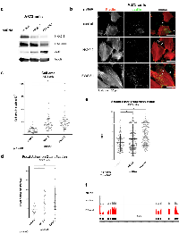 Figure 2:  NKX2-2 impairs the capacity of A673 Ewing sarcoma cells to spread on the substrate and to form actin stress  fibers and focal adhesions. 