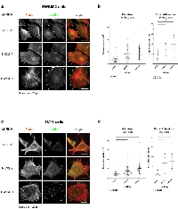 Figure 3:  NKX2-2 represses mesenchymal features in two other Ewing sarcoma cell lines. 