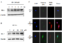 Figure 2:  Elk-1 is activated by resveratrol. 