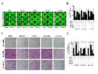 Figure  2:  Effect  of  silencing  Gα-subunits  on  the  migration  of  SKOV3  cells.  (A) 