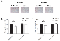Figure 5:  Impact of METi on the microvessel density in NIH3T3 MET M1268T and Y1248H liver tumor sections. 