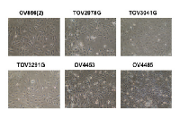 Figure 1: Morphology of cell lines derived from  patients 866, 2978, 3041, 3291, 4453 and 4485. 