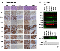 Figure 4:  Immunostaining of cell lines and corresponding solid tumors. 