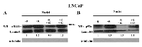 Figure 5:  Effect of AR/p52-02 on levels of AR and p52 NF-κB subunit in androgen-dependent LNCaP cells. 