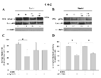 Figure 6:  Effect of AR/p52-02 on levels of AR and p52 NF-κB subunit in castration-resistant C4-2 cells. 