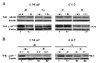 Figure 7:  Effect of AR/p52-02 on AR phosphorylation. 