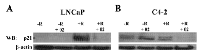 Figure  9:  AR/p52-02  reduces  the  level  of  p21  in  the  presence of androgen. 