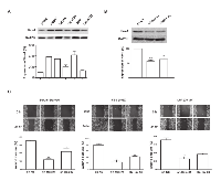 Figure 1: Silencing of Hax-1 attenuates LPA and FBS stimulated migration of SKOV3 cells. 