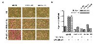 Figure 2:  Silencing of Hax-1 attenuates LPA and FBS stimulated invasive migration of SKOV3 cells. 