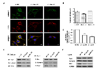 Figure 3:  Silencing of Hax-1 attenuates Rac1-cortactin complex formation. 