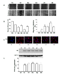 Figure 5:  Expression of Rac1-interacting domains of Hax-1 inhibits the migration of SKOV3. 