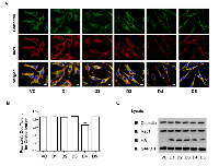 Figure 6:  Expression of Rac1-interacting D4 domain of Hax-1 attenuates Rac1-cortactin complex formation. 