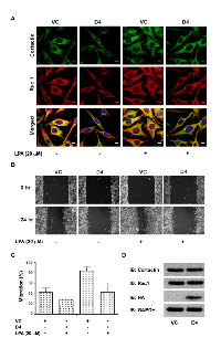 Figure 7:  Expression of Hax-D4 attenuates LPA stimulated Rac1-cortactin complex formation in SKOV3 Cells. 