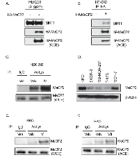 Figure 1: SIRT1 binds to MeCP2 and deacetylates it in multiple cell lines. 