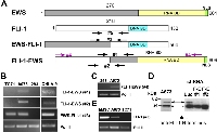 Figure 1: Expression of FLI-1-EWS in Ewing sarcoma cells. 