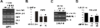 Figure 3:  FLI-1-EWS silencing inhibits Ewing sarcoma proliferation. 