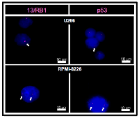 Figure 1:  Cytogenetic analyses of MM cell lines (U266, RPMI-8226) by FISH technique. 