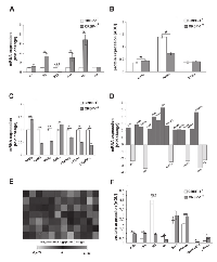 Figure 4:  CRBP-1 transfection influences transcriptional pathways and differentiation of A549 adenocarcinoma cells. 