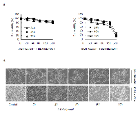 Figure 1: 3-BrPA affects the cell viability of breast cancer cells.