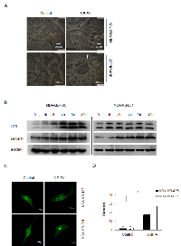 Figure 2:  3-BrPA induces autophagy in breast cancer cells. 