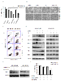 Figure 3:  Autophagy inhibition enhances 3-BrPA-induced cell death in vitro . 
