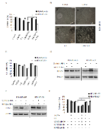 Figure 4:  3-BrPA and CQ co-operate to induce RIPK1-dependent apoptosis in MDA-MB-435 cells, but induce RIPK1/3- dependent necroptosis in MDA-MB-231 cells. 