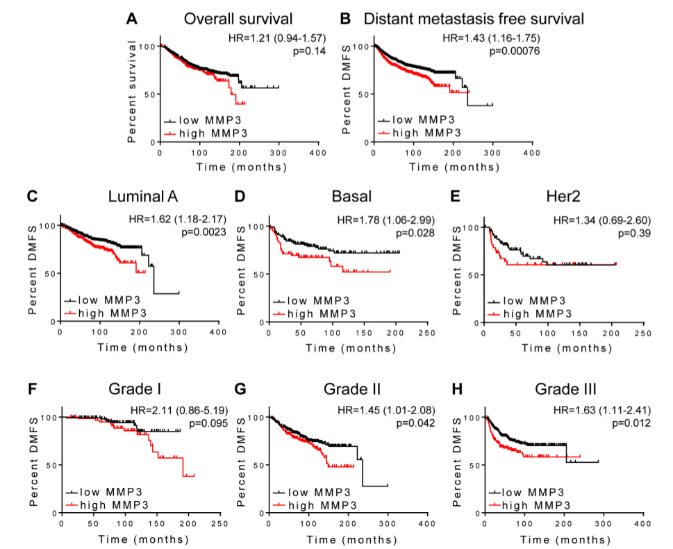Figure 3:  MMP3 association with outcome in breast carcinoma. 