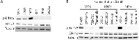 Figure 4:  Western blot analysis of ERK phosphorylation in 6 osteosarcoma cell lines and effect of MEK inhibition. 
