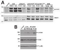 Figure 3:  Restoration of aberrant activation of MAPK and Jak/STAT pathways in loss of function mutants of  p185BCR/ABL by T315I. 