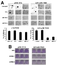 Figure 5:  Role of endogenous BCR in the resistance of T315I mutation. 