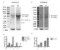 Figure  2:  Expression  profile  of  WT1  isoforms  in  undifferentiated  and  RA  differentiated  neuroblastoma  cells. 