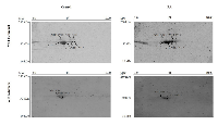 Figure  3:  Representative  2D  gel  immunoblots  of  WT1  protein  isoforms  expressed  in  undifferentiated  and  RA  differentiated neuroblastoma cells. 