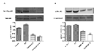 Figure 5:  Phosphorylation of AKT and ERK1/2 in undifferentiated and RA differentiated neuroblastoma cells. 