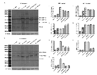 Figure 6:  Expression profile of WT1 isoforms after inhibition of the phosphoinositide 3-kinase (PI3K)/Akt signaling  pathway or of the mammalian mitogen activated protein kinase/Erk kinase (MAPPK or MEK) family. 