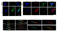 Figure 7:  Immunolocalization of WT1 isoforms and Nestin in undifferentiated and RA differentiated neuroblastoma  cells. 