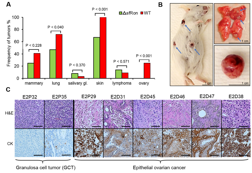 Genes & Cancer | Short-form Ron is a novel determinant of