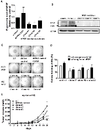 Figure 4:  Down-regulating bFGF level is sufficient to inhibit the AIG of FO myeloma cells. 