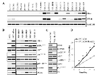 Figure 1: Evaluation of the Ron receptor isoforms expression and the activity of sfRon signaling pathways in ovarian  tumors. 