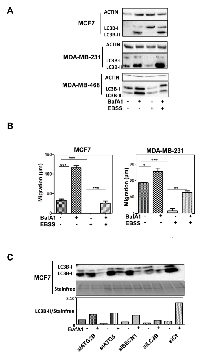 Figure 5:  Autophagy directly affects cancer-related phenotypes. 