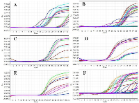 Figure 1: An amplification curves of CDKs showing respective Ct values for two distinctive stages early (II) and  advanced stages (II & IV) of pre-and postmenopausal BC patients. 