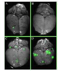 Figure 2: Images of brain metastases from PCI and treatment groups at 8 weeks after injection of GFP-labeled  tumor cells. 