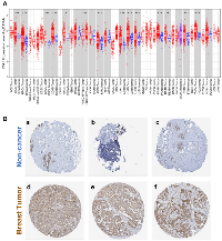 Figure 1: Expression of human Dishevelled-1 (DVL1) in different tumor types. 