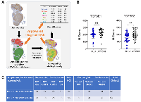 Figure 2: AI-based analysis of TGFBR1 and TGFBR2 staining intensity in HCC and cirrhotic tissue.