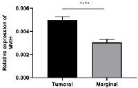 Figure 1: Expression of lncRNA MVIH in CC tumor as compared to marginal non-tumor tissues. 