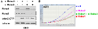 Figure 7: The silencing of Robo1/2 receptors activates cdc42 and inhibits Ewing sarcoma cell proliferation. 