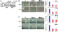 Figure 8: Slit2 signaling stimulates the transformed phenotype of Ewing sarcoma cells. 