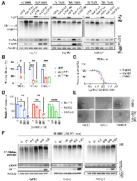 Figure 2: VCP is required for PDAC growth and polyubiquitinated protein degradation.