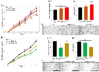 Figure 2: Overexpression of distinct BRD4 isoforms has opposing roles in promoting ovarian cancer cell proliferation 